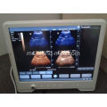 Harga Mesin Ultrasound Pengimbas Ultrasound Portable